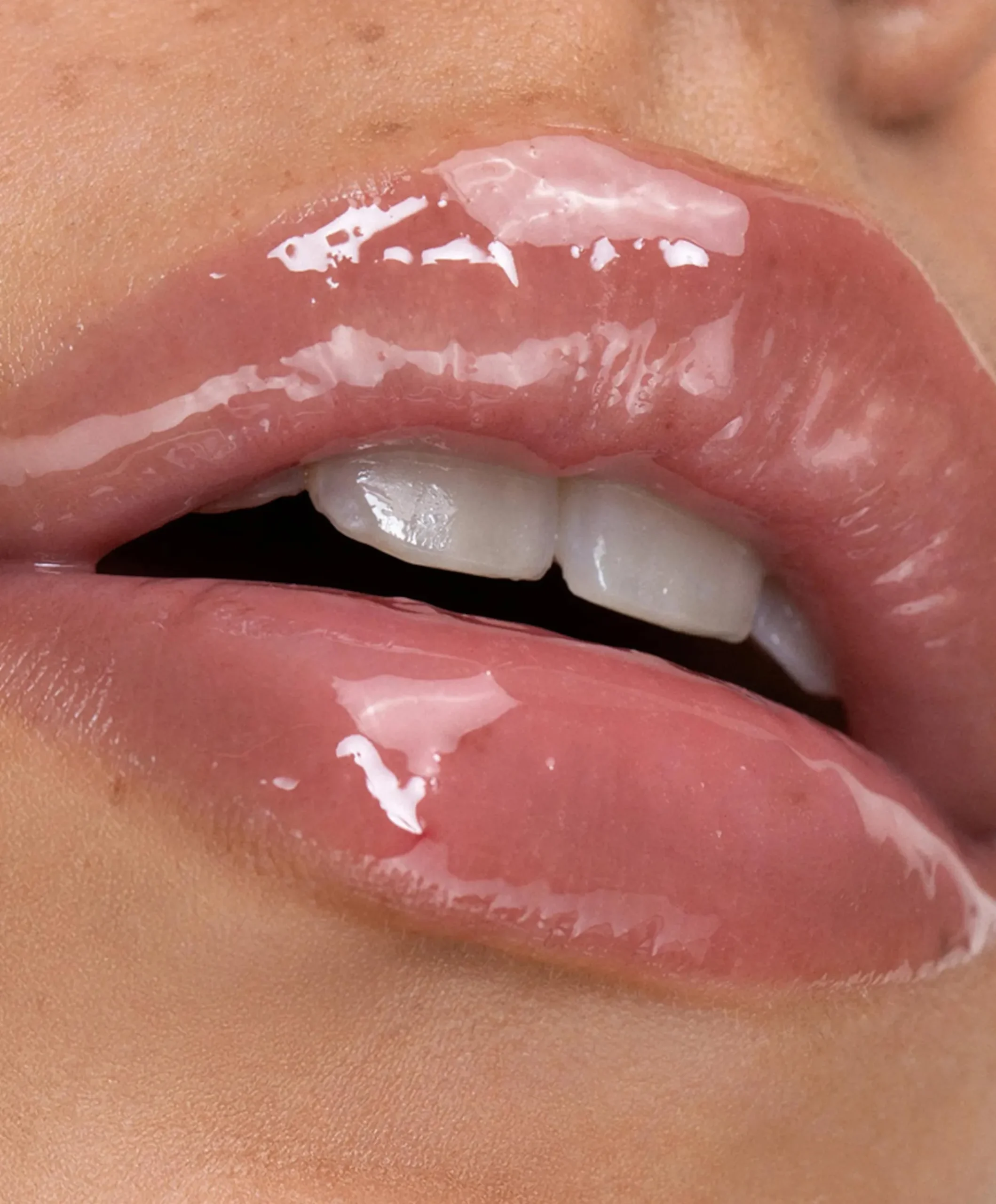Lipolie roze